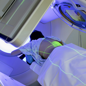Woman Receiving Radiation Therapy/ Radiotherapy Treatments for Thoracic Cancer